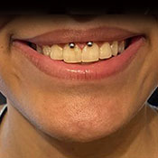 piercing
